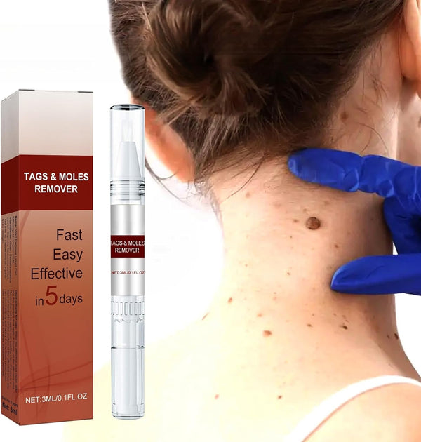 Tags and Moles Remover